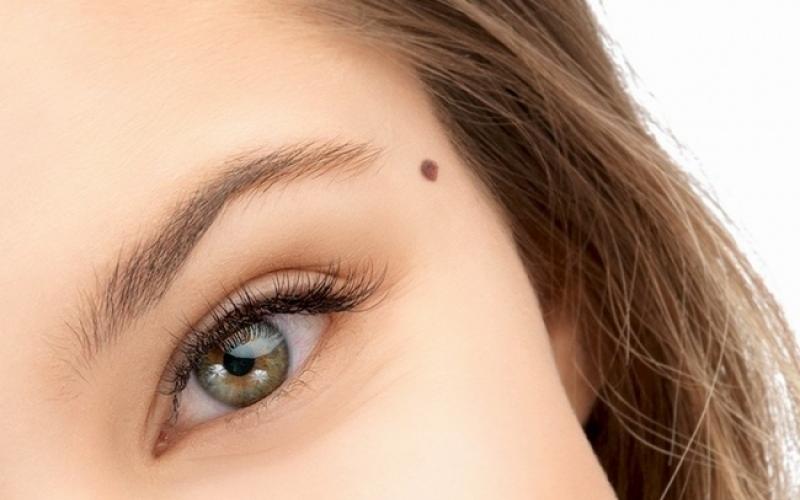 The meaning of moles on your body